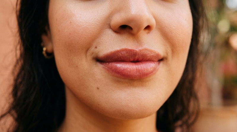 Filler lèvres à Draria — Fresh Skin Clinic
